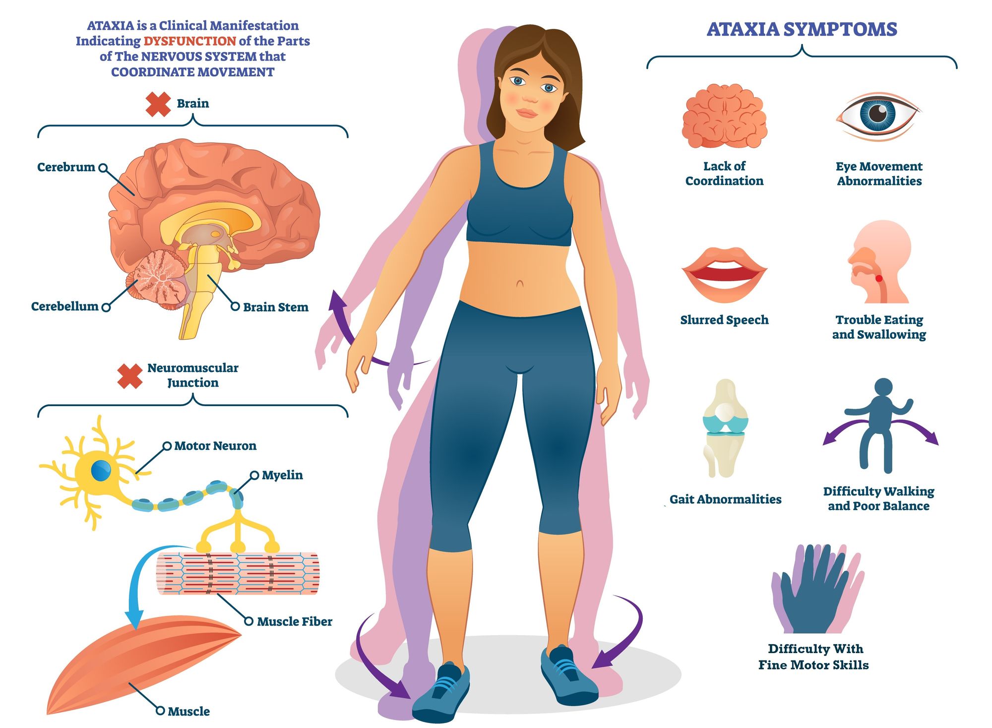 Ataxia